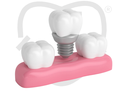 Próteses Dentárias
