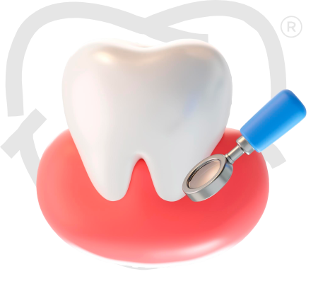 Preventiva